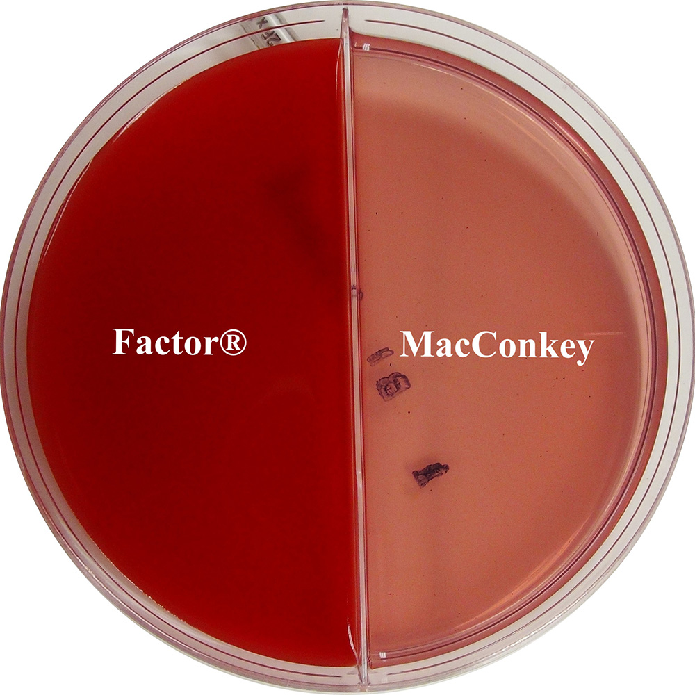Minnesota easy culture biplate - factor and MacConkey labelled plate