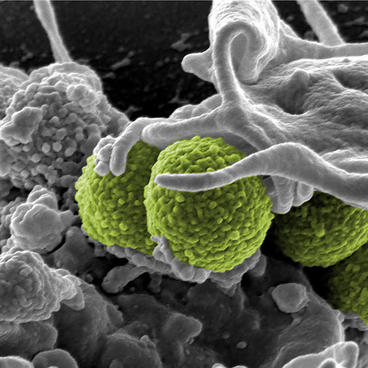 microscopic antimicrobial resistance